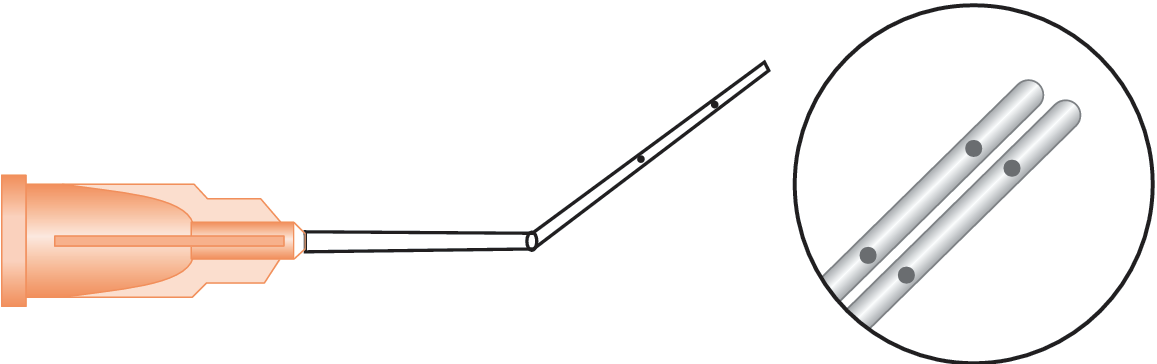 Lasik Double Arm Cannula (Vidaurri)